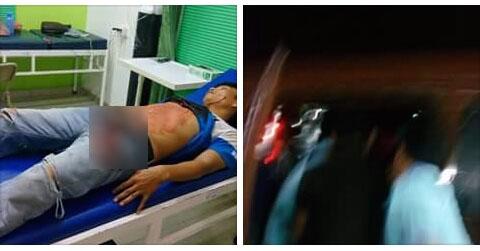 Ganti Sabu dengan Tawas, Pengedar Kampung Aceh Ditikam 