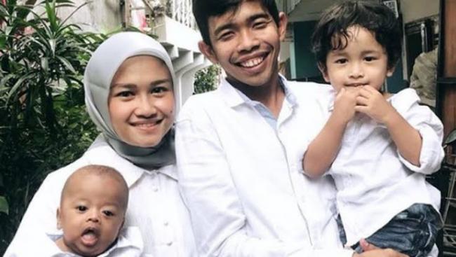 Anak Idap Sindrom Williams, Dede Sunandar Rela Jual Organ Tubuh
