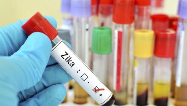   Seorang Wanita Terjangkit Zika Setelah Pulang dari Singapura