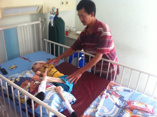 Bocah Gizi Buruk Ini, di Usia 10 Tahun Miliki Berat Badan Cuma 8 Kg  