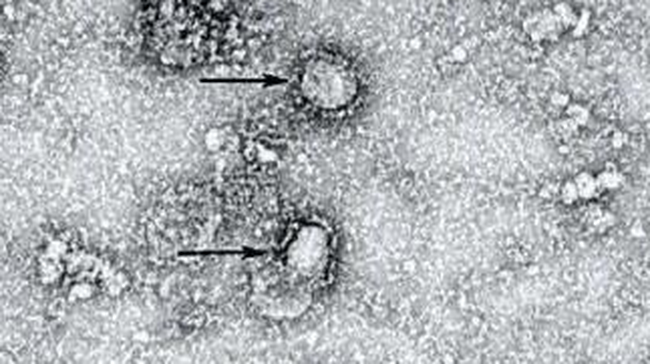 Peneliti: Virus Corona Bisa Bunuh 65 Juta Jiwa dalam 18 Bulan 