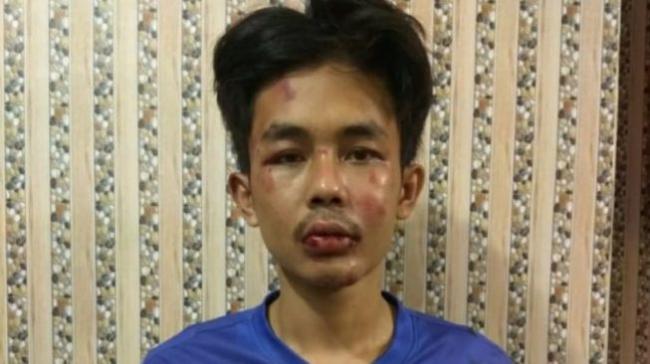 Penusuk Syekh Ali Jaber Stres Gegara Ibu Nikah Lagi, Polisi Tak Percaya