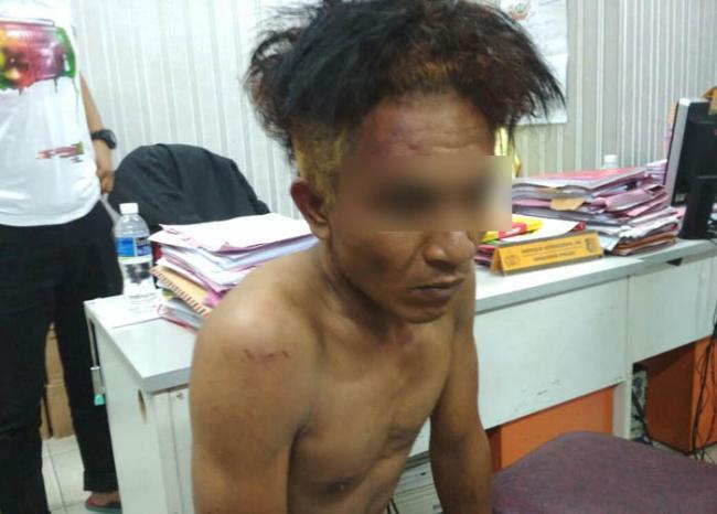 BREAKING NEWS: Leher Ditempel Pisau, Karyawati Mukakuning Diperkosa Sopir Angkot