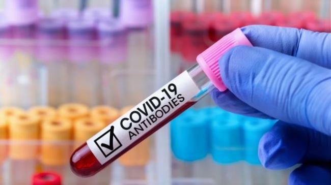 Penelitian Terbaru: Antibodi Covid-19 Menurun Cepat dalam 1 Bulan