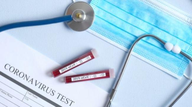Terbaru, Singapura Konfirmasi 7 Orang Terinfeksi Virus Corona