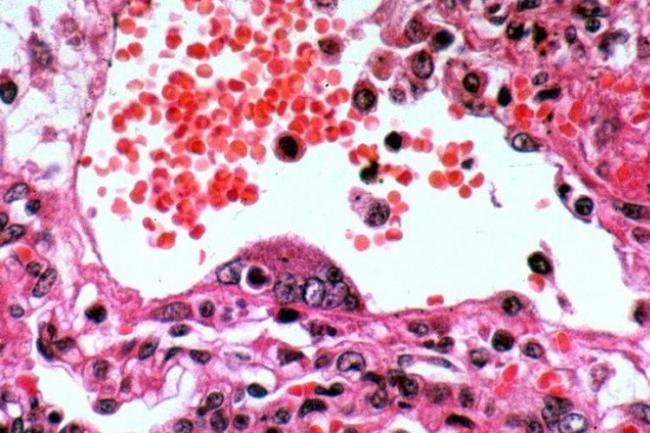 Covid-19 Belum Reda, Pemprov Kepri Kini Waspada Virus Nipah dari Malaysia