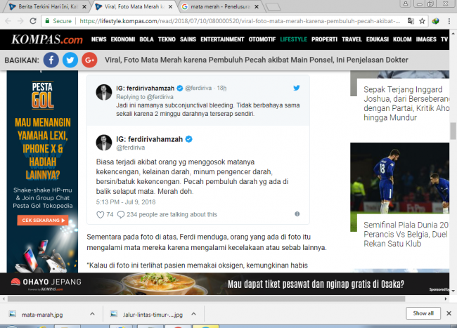 Dokter Mata: Pembuluh Darah Mata Pecah Akibat Main Ponsel Itu Hoax