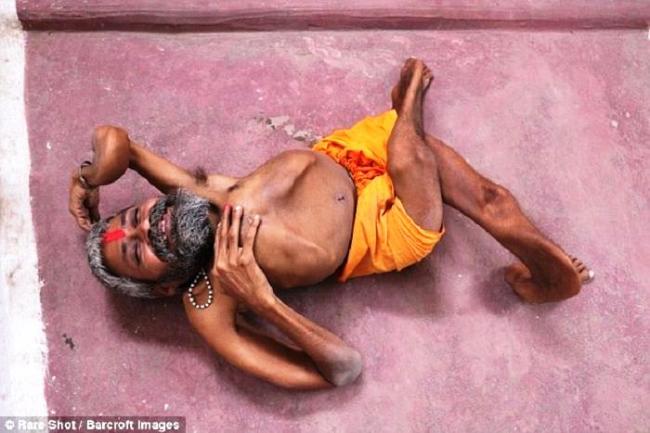 Bharat Tiwari Pendeta India, Alami Perubahan Bentuk Tubuh Misterius