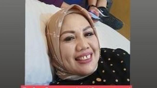 Potong Gigi Bikin Pangling, Elly Sugigi Lakukan Demi Berondong?