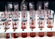 Pria AS Bocorkan Database Kesehatan Singapura, Status HIV 14.200 Pasien Tersebar  