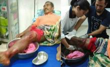 Kaki Sidah Nyaris Putus Diterkam Buaya di Kolam Bekas Tambang 