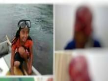 Terlilit Baling-baling Mesin Pompong, Kulit Kepala Murid SMP di Senayang Ini Terkelupas