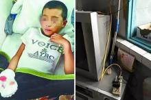 Charger Ponsel Meledak, 4 Jari Bocah Ini Putus 
