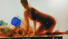  Takut Kehilangan Tas, Wanita Ini Ikut Masuk ke Mesin X-Ray