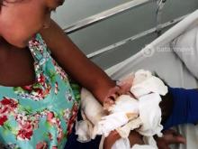 Balita Lima Tahun di Batam Terbakar Saat Ibunya Masak Kue Lebaran