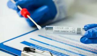 Batam Send Hundreds of Swab Samples to Balitbangkes Examining Corona Mutations