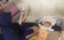 Bayi Berkepala 2 Lahir di Batam, Apa Penyebabnya?