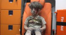 [VIDEO] Tatapan Kosong Bocah Suriah di Ambulans Ini Membuat Dunia Menangis