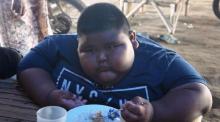 Obesitas Ekstrem, Anak Pemilik Warung Makan Ini Berbobot hingga 97 Kg