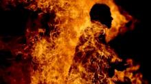 Menyakitkan, Ini Yang Terjadi Saat Tubuh Manusia Terbakar