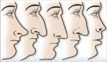 10 Bentuk Hidung Cerminkan Kepribadian Anda