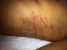 Kepala Rutan: Kalau Tak Direspon, Saya Letak Jenazahnya di Depan Kantor Kejari Batam!
