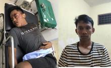 Apes, Maling di Tanjungpinang Keok Gegara Terpleset
