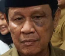 Teka-teki Mata Lebam Plt Gubernur Isdianto, Jatuh atau Kena Pukul?