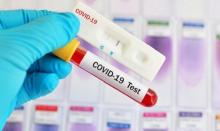 348 Petugas Pencoklit Pilkada Bintan Belum Jalani Rapid Test