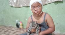 Meski Sering Dicakar, Bocah Ini Tetap Sayangi Kucing Peliharaannya