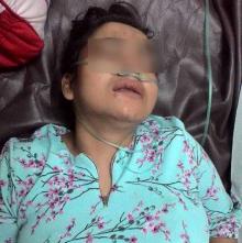 Polisi Menduga Dwi Kumalasari Alami Stres Berat