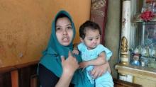 Idap Penyakit Langka, Bibir Bayi Salsa Terkikis Secara Perlahan