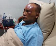Seorang Warga Batam Dikeroyok Warga Negara Asing Hingga Bonyok
