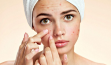 10 Obat Jerawat yang Bisa Bikin Muka Jadi Kinclong