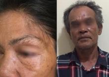 Sering Pukul Istri, Lian Dilaporkan ke Polsek Tebing Karimun