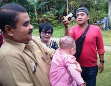 Bayi Asal Karimun Pengidap Meningo-ensefalokel Akhirnya Sembuh