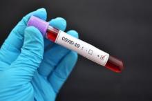 Ahli UGM: Minum dan Mandi Air Panas Tak Bisa Bunuh Virus Corona