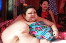 Suami Wanita Berbobot 350 Kg Tak Setuju Istrinya Dibedah