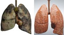 Ini 10 Cara Efektif Bersihkan Paru-paru Dalam 2 Hari 