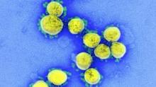 WHO Sebut Mutasi Virus Tak Bikin Covid-19 Makin Mematikan