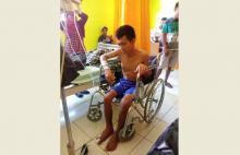 Jari Kaki Pemuda Natuna Ini Tiba-tiba Mati dan Menghitam