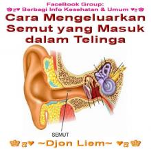 [Jurnalisme Warga] Cara Mengeluarkan Semut dari Dalam Telinga