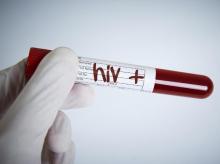 Pria Meninggal karena AIDS, 40 Wanita yang Dipacari Shock