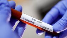 Singapura Konfirmasi Satu WNI Positif Virus Corona