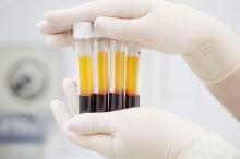 Plasma Darah Pasien Corona yang Sembuh Dijual di Pasar Gelap Online
