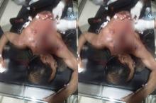 Dituduh Maling, Pria di Bintan Ini Kritis Disabet Parang