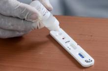 Harus Diulang, Rapid Test Tak Cukup Sekali!