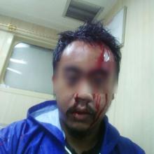 Bentrok, Massa Penyelundup Lempar Kepala Seorang Petugas BC hingga Sobek