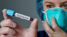 Uji Swab Covid-19 Akan Dilakukan di Batam, Tidak Lagi di Jakarta