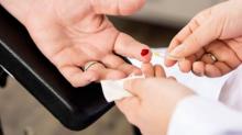 Jangan Tusuk Jari Penderita Stroke dengan Jarum!